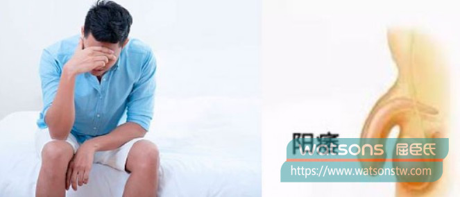 哪類人可考慮天天吃威而鋼？哪些人則不適合？