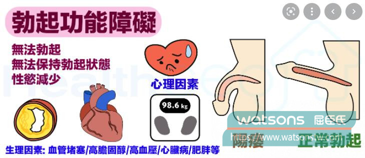 性慾低與勃起障礙，是兩回事嗎？